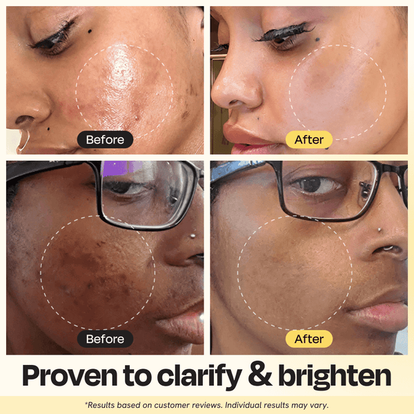Radiant Glow Vitamin C Clay Mask